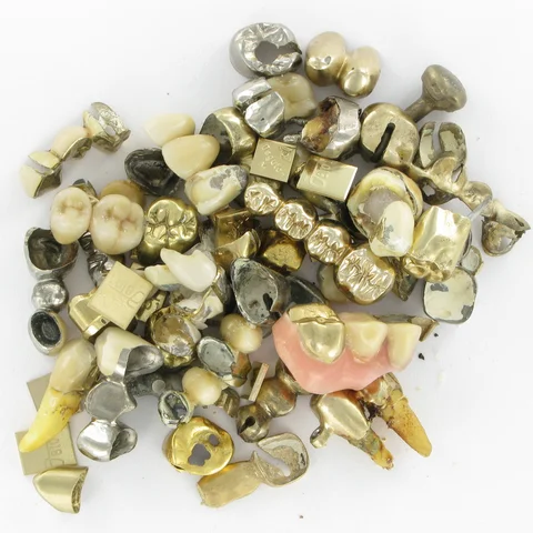 Zahnarzt Edelmetallscheidgut / Zahngold
