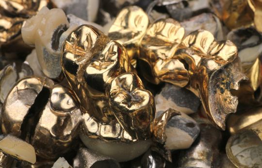 Dentalgold / alte Goldkronen