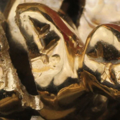 Goldkronen