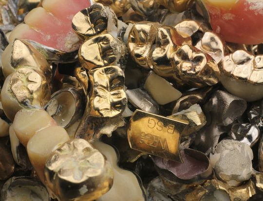 Altes Zahngold / Goldkronen