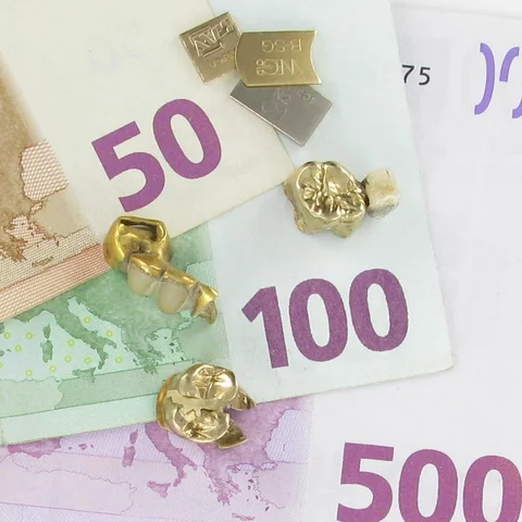 Gold ist teuer - Zahngold bringt viel Geld und ist wertvoll