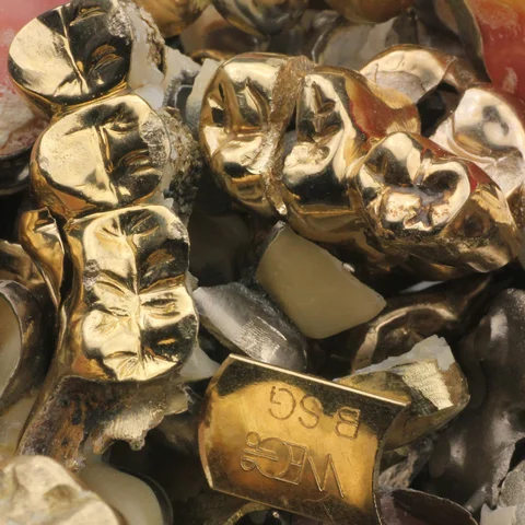 Zahngold Kronen